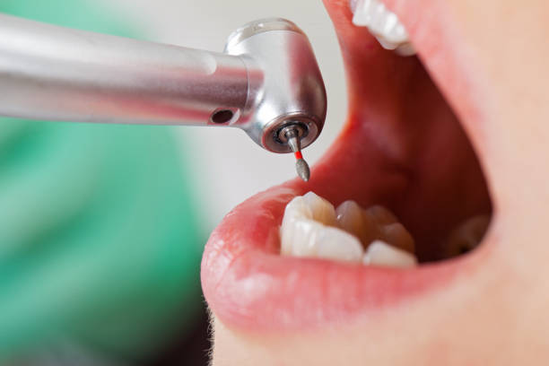 Best Holiday Emergency Dentist in Cameron, TX